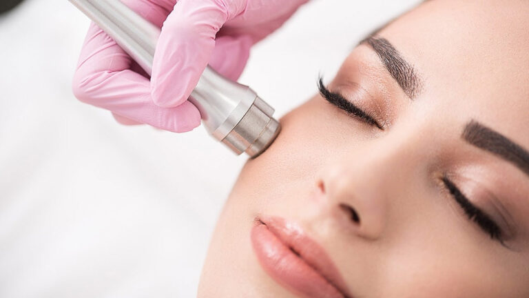 microdermabrasion